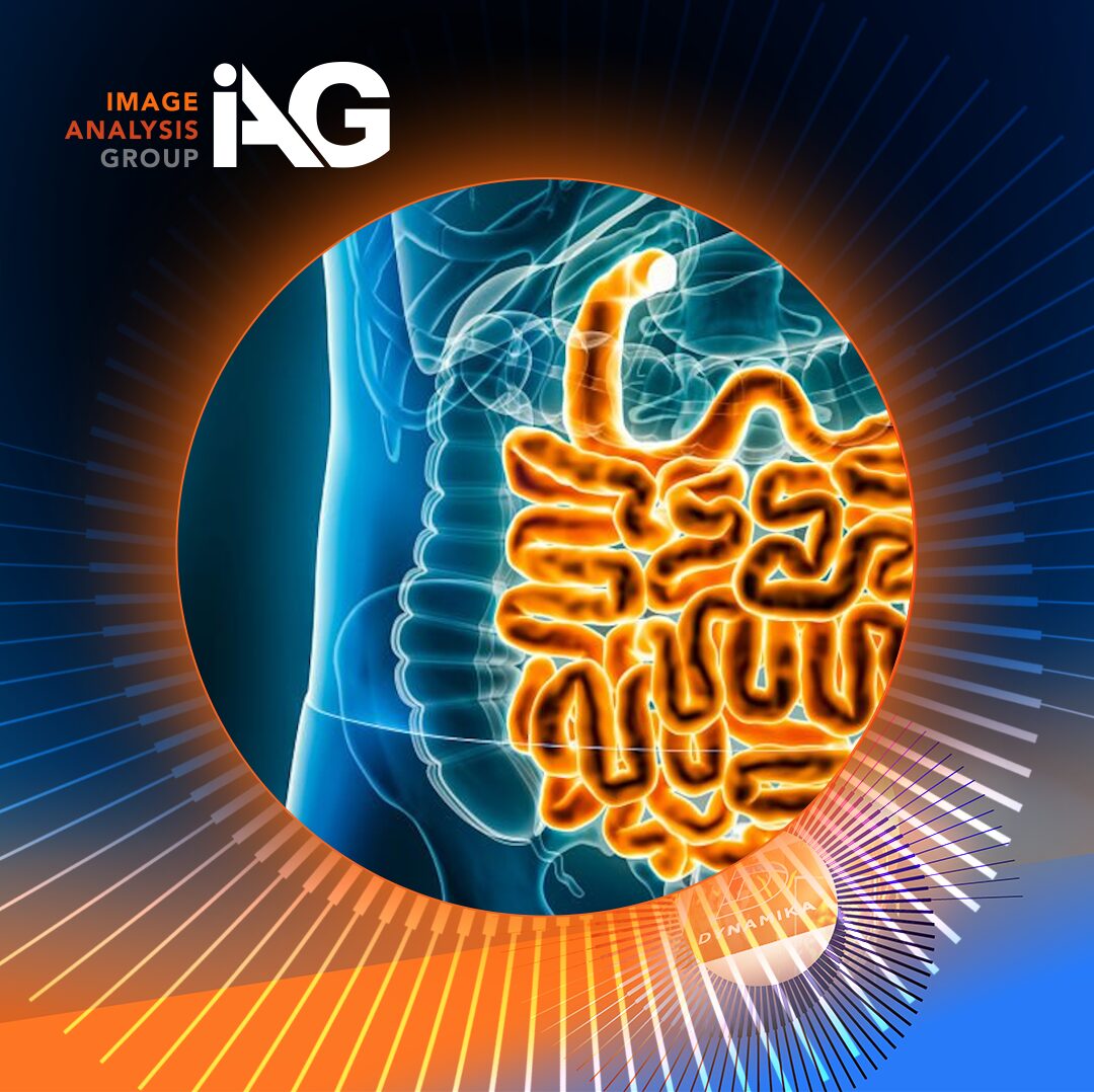 Eli Lilly and Image Analysis Group partnership illustration for AI‑enabled MRI imaging in IBD clinical trials.